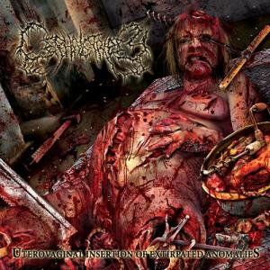 Intracranial Butchery