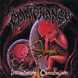 Intrauterine Cannibalism