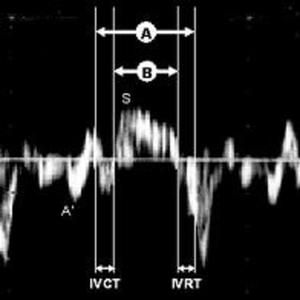 Annular Velocity