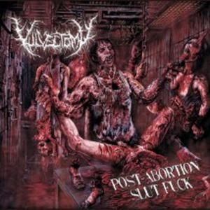 Eugenic Sterilization