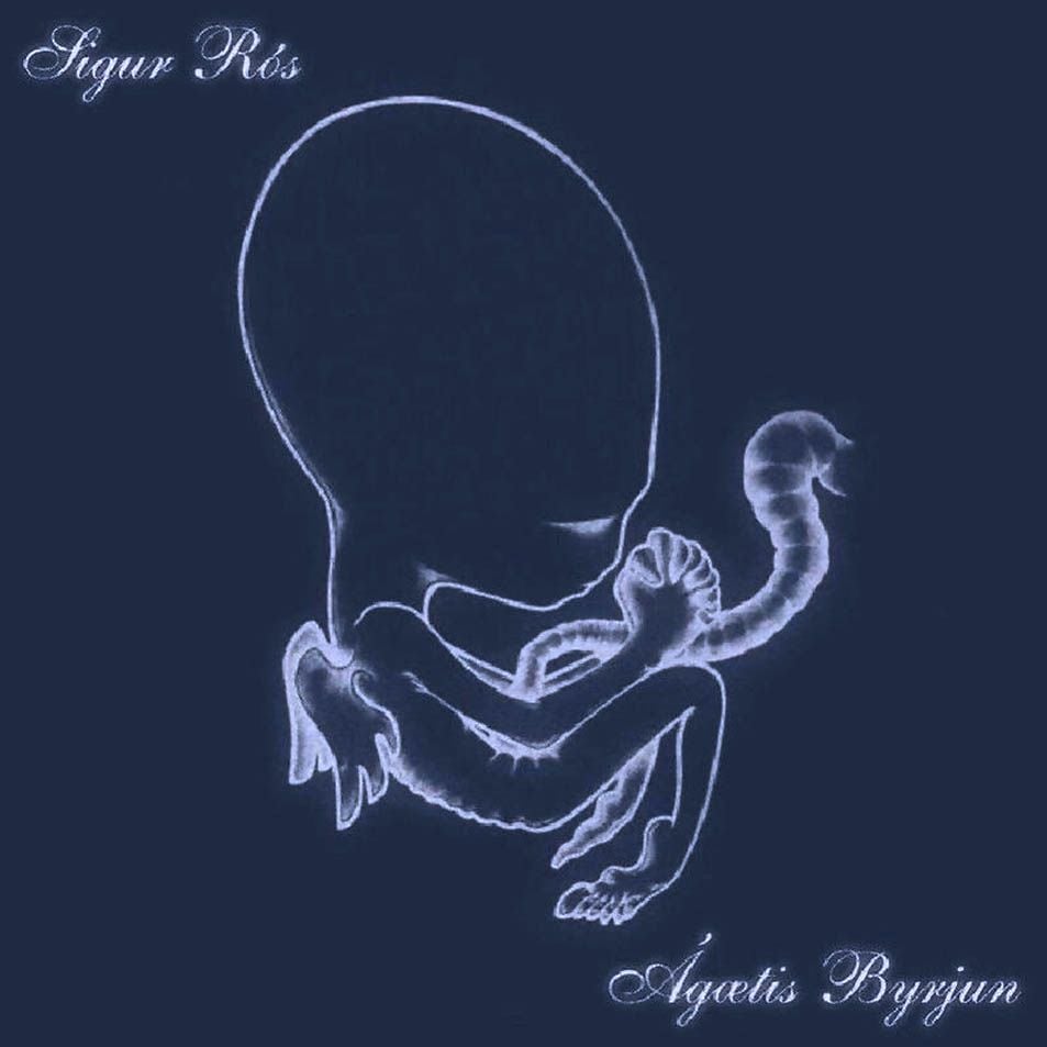 sigur ros agaetis byrjun year