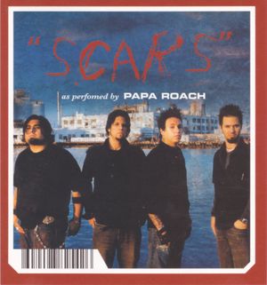 Scars (Single)