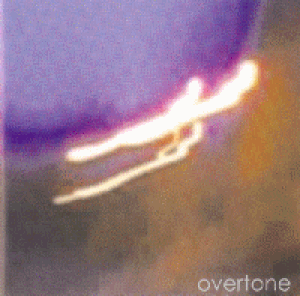 Overtone