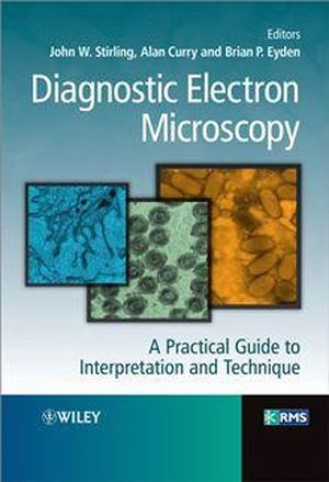 Diagnostic Electron Microscopy