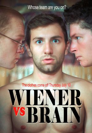 Wiener vs. Brain