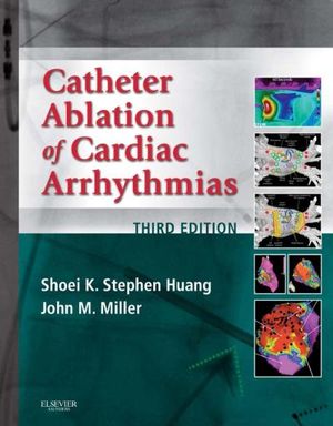 Catheter Ablation of Cardiac Arrhythmias