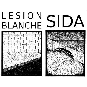 Lésion Blanche / SIDA (K7 split)