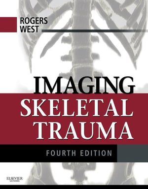Imaging Skeletal Trauma