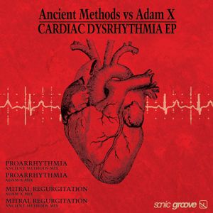 Cardiac Dysrhythmia EP (EP)