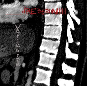 Processus Spinosus