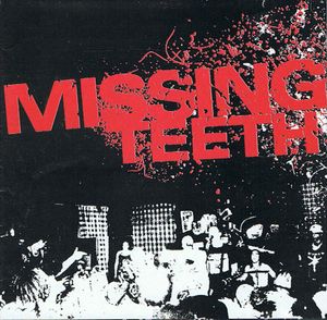 Missing Teeth