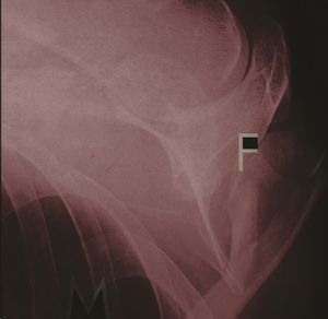 Pain Is on Our Side Now (EP)
