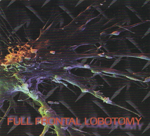 Full Frontal Lobotomy