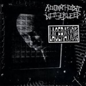 Agoraphobic Nosebleed / Laceration (EP)