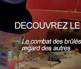 image-https://media.senscritique.com/media/000017095291/0/burns_and_smiles_le_combat_des_brules_pour_changer_le_regard_des_autres.jpg
