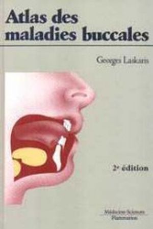 Atlas des maladies buccales