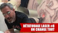 Détatouage Laser #8 : Je Change De Technique