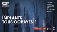 Implants : tous cobayes ?