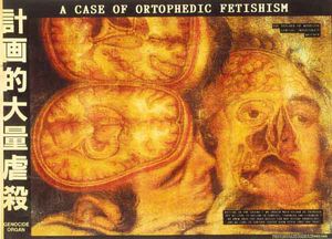 A Case of Orthopedic Fetishism (Single)