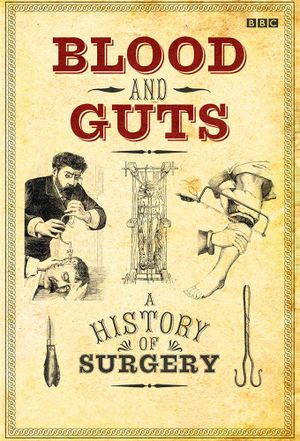 Blood and Guts: A History of Surgery