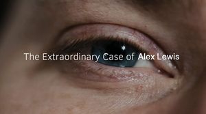 The Extraordinary Case of Alex Lewis