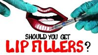 Should You Get Lip Fillers?