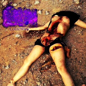 Colectomy (Single)