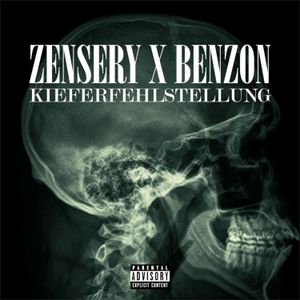 Kieferfehlstellung (Single)