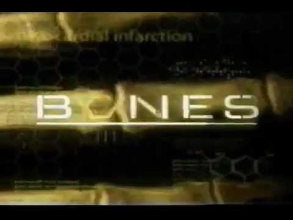 Bones