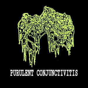 Purulent Conjunctivitis (Single)