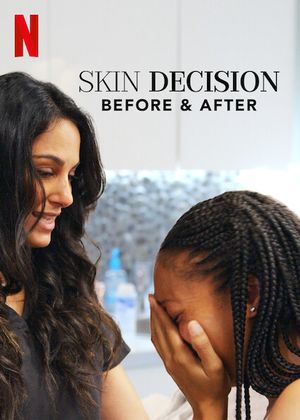 Skin Decision: Before & After