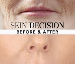 image-https://media.senscritique.com/media/000019549790/0/skin_decision_before_after.jpg