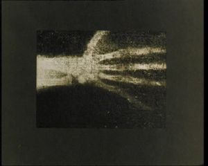 Cinéradiographie indirecte