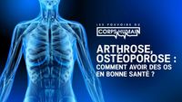 Arthrose, Ostéoporose : comment avoir des os en bonne santé
