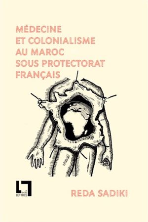 Médecine et colonialisme au Maroc sous protectorat français