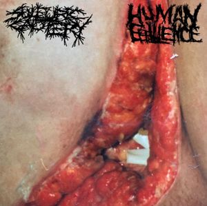 Sulfuric Cautery / Human Effluence (EP)