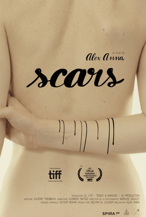 Scars