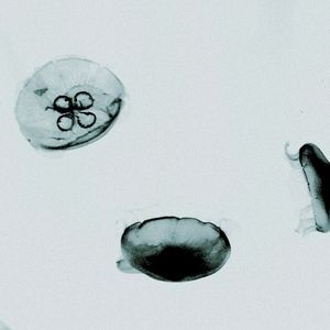 Mist Theory