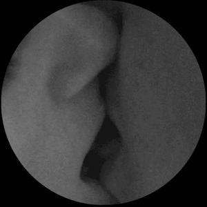 Lovers In A Dystopian World (Single)