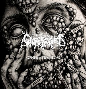 Generation Loss (EP)