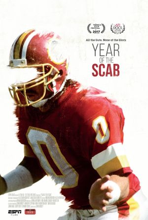 ESPN 30 for 30: Year of the Scab