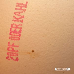 Der Scheiß