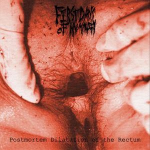 Postmortem Dilatation of the Rectum (EP)