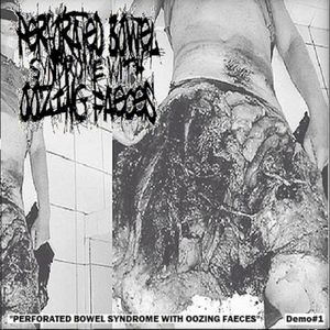 Perforated Bowel Syndrome With Oozing Faeces (EP)
