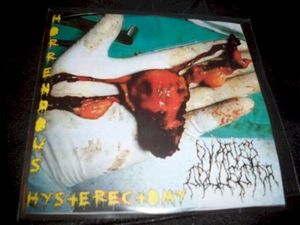 Horrendous Hysterectomy (EP)