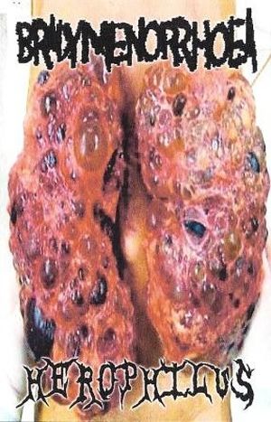 Xenozygomycosis