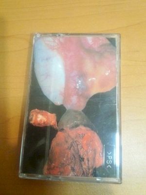 Cadaverjelly Saponification / Black Market Organ Donor (EP)