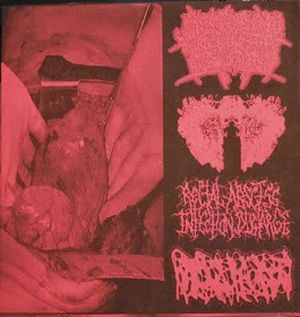 4-Way Gorenoise Split