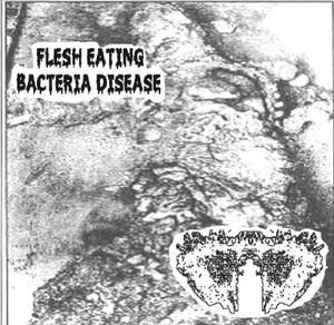 Flesh Eating Bacteria Disease / Carcinomas Of Unknown Primary Origin