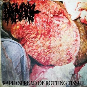 Rapid Spread of Rotting Tissue